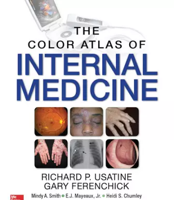 COLOR ATLAS OF INTERNAL MEDICINE